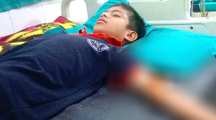 बाँदरको आक्रमणबाट विद्यालयबाट घर फर्किरहेका विद्यार्थी घाइते